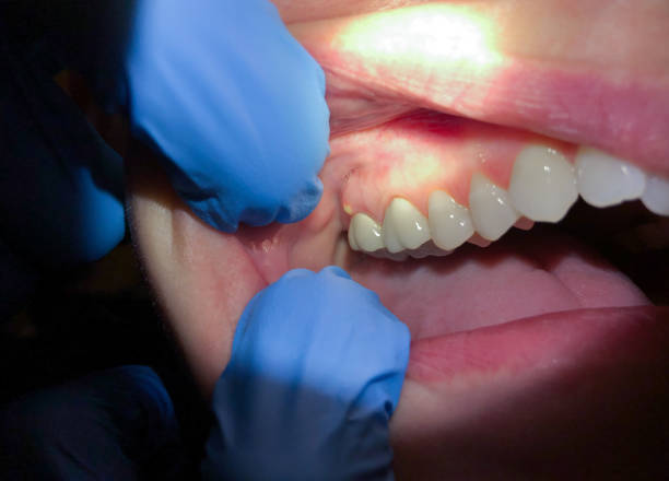 Best Walk-In Emergency Dental Services in Goldens Bridge, NY