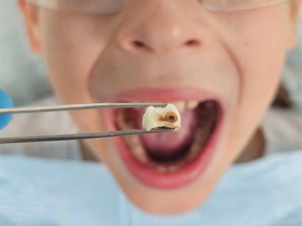 Best Emergency Pediatric Dental Care in Goldens Bridge, NY